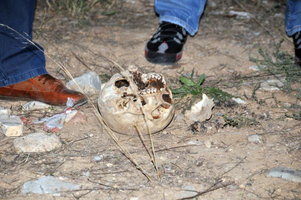 Üniversite Arazisinde İnsan Kafatası Bulundu