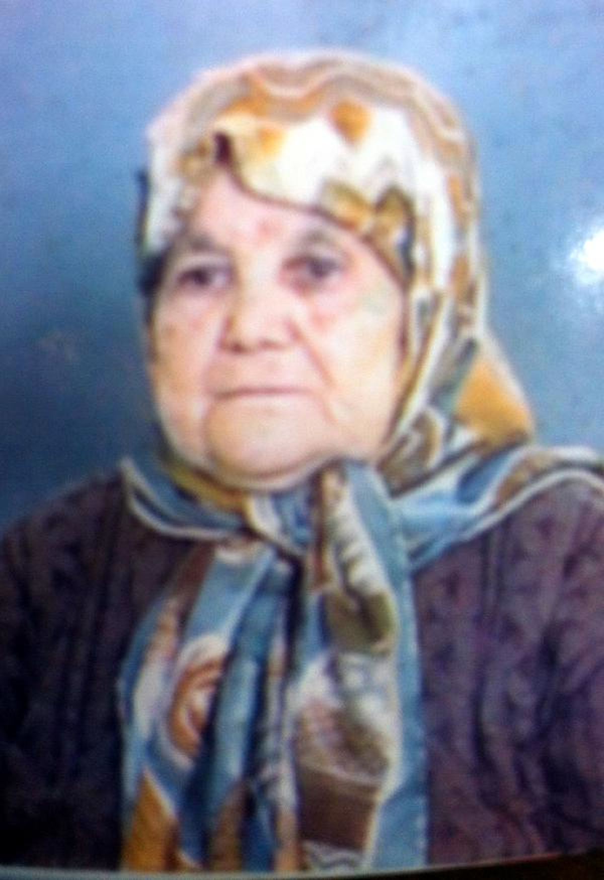Kurban Eti Pişirirken Elbisesi Tutuştu