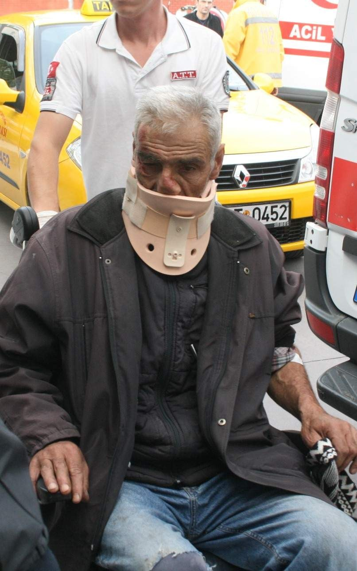 Motosikletten Düşen Sürücü Yaralandı