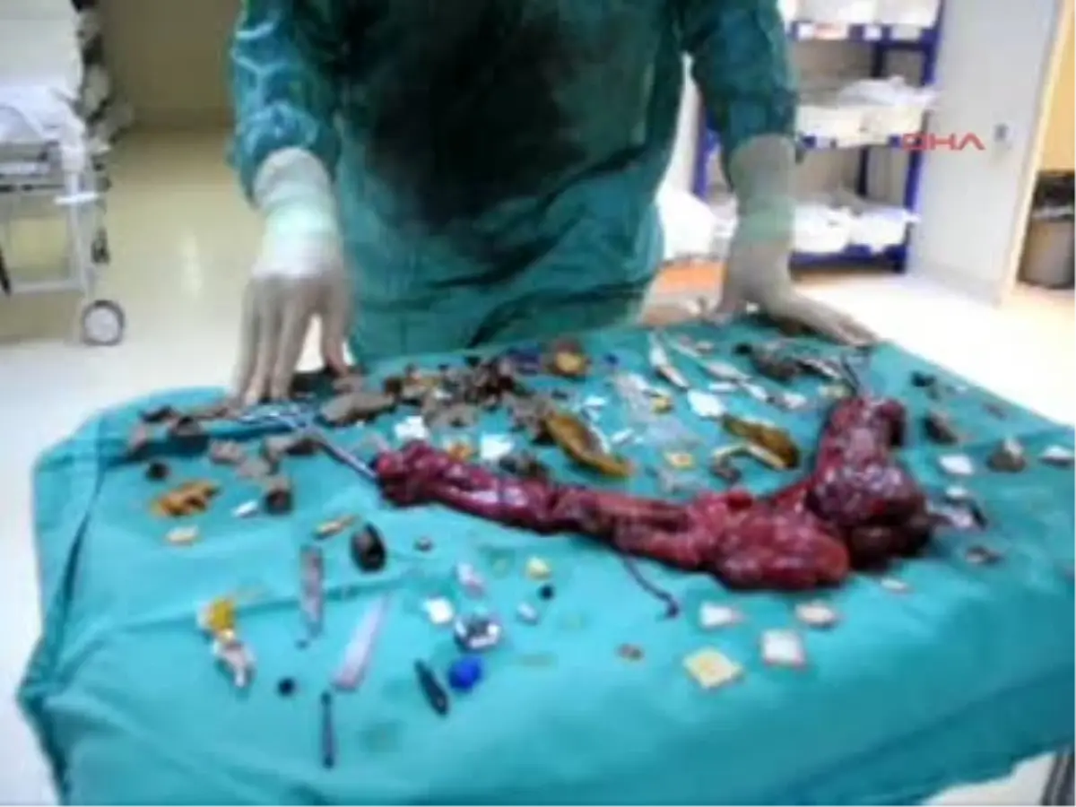 İskenderun Şizofreni Hastası Eline Ne Geçtiyse Yutmuş