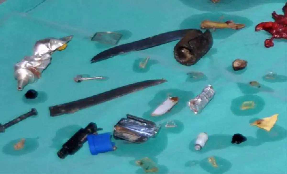 Şizofreni Hastası Eline Ne Geçtiyse Yutmuş