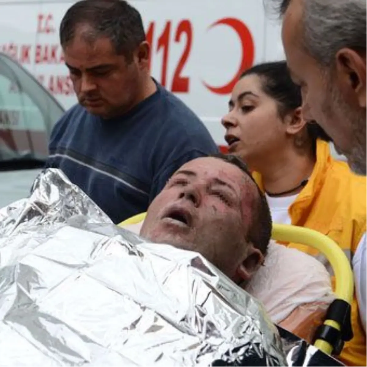 Başbakanlık Yakınında Bir Kişi Kendini Yakma Girişiminde Bulundu