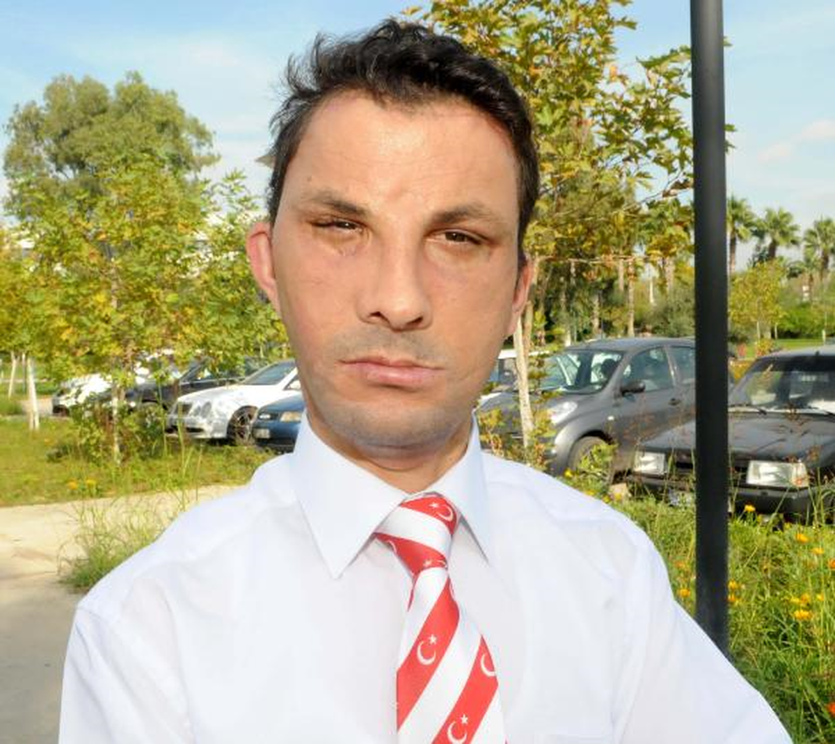 Gençleşen Yeni Yüzüyle Kimse Tanıyamıyor