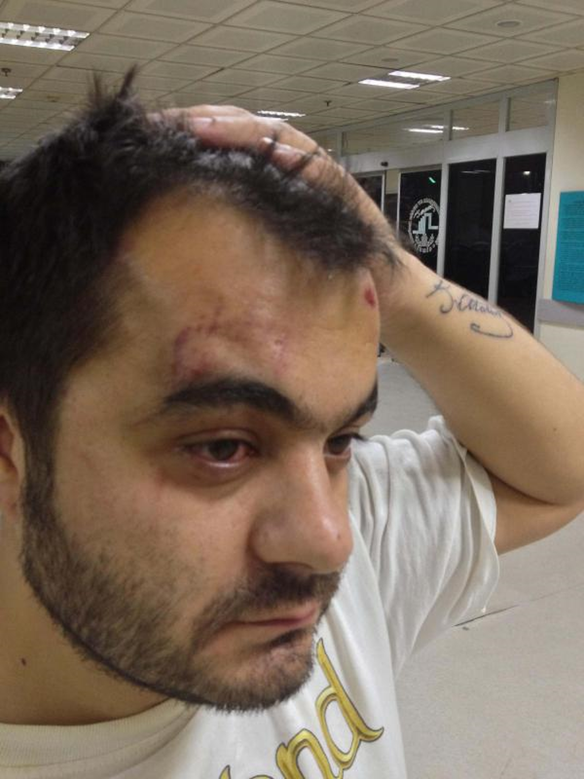 Polisin Kimlik Kontrolünde Dayak İddiası