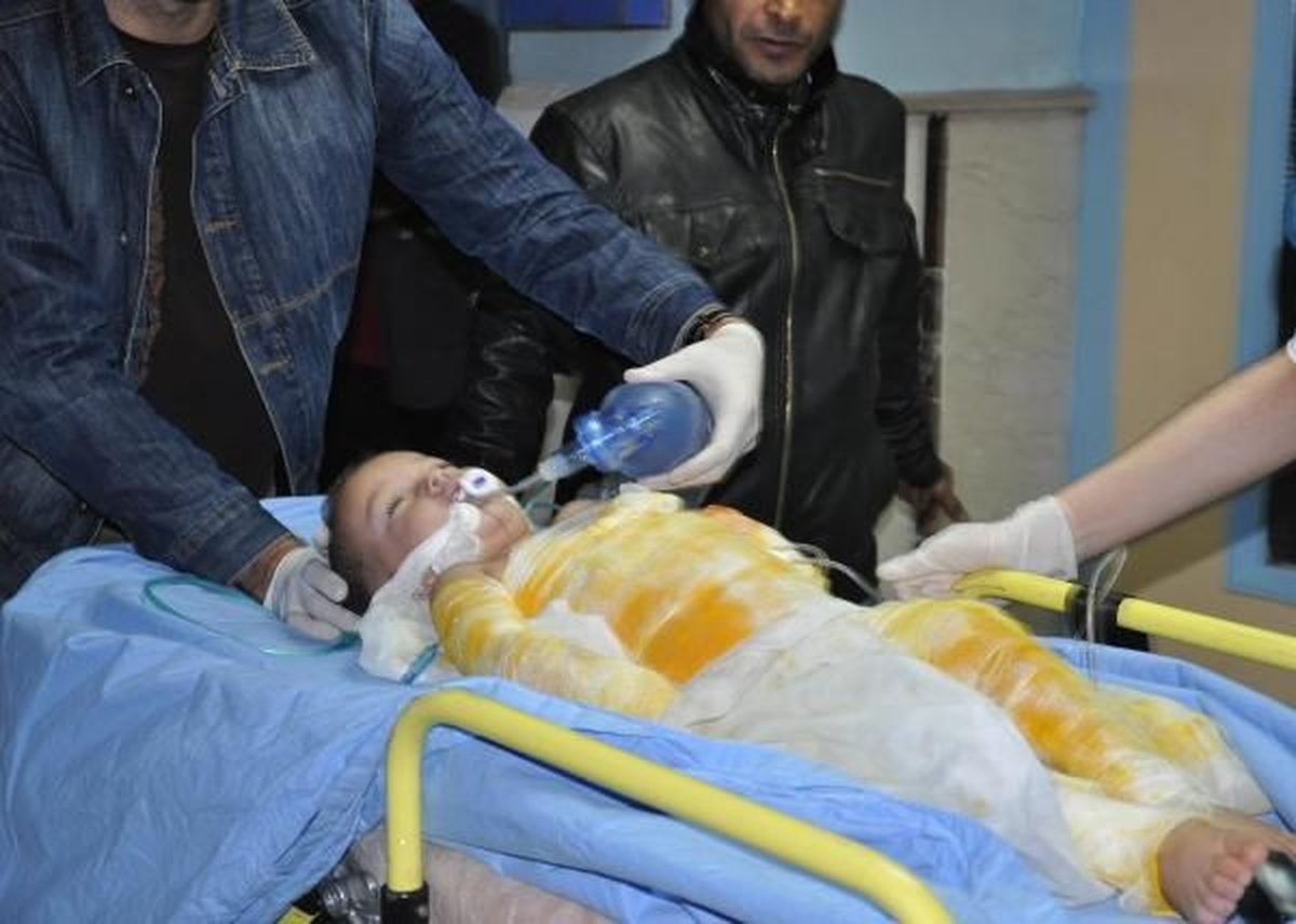 Çadır Kentte Çorba Kazanının Üzerine Düşen Çocuk Yandı