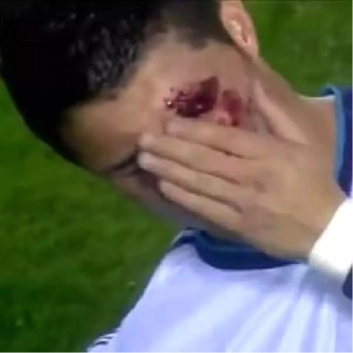 Ronaldo Kan Revan İçinde Kaldı