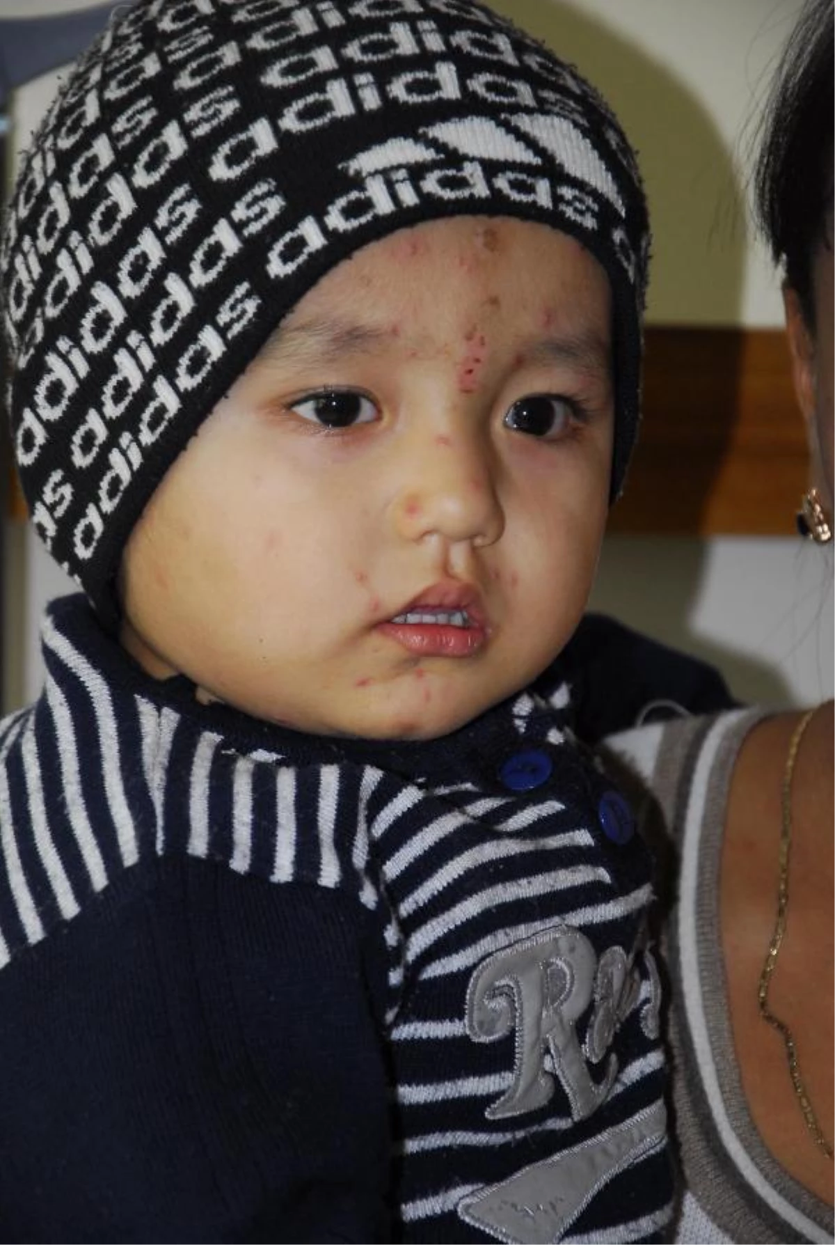 Özbek Çocuk, İzmir\'de Yapılan Tıbbi Operasyonla Duymaya Başladı
