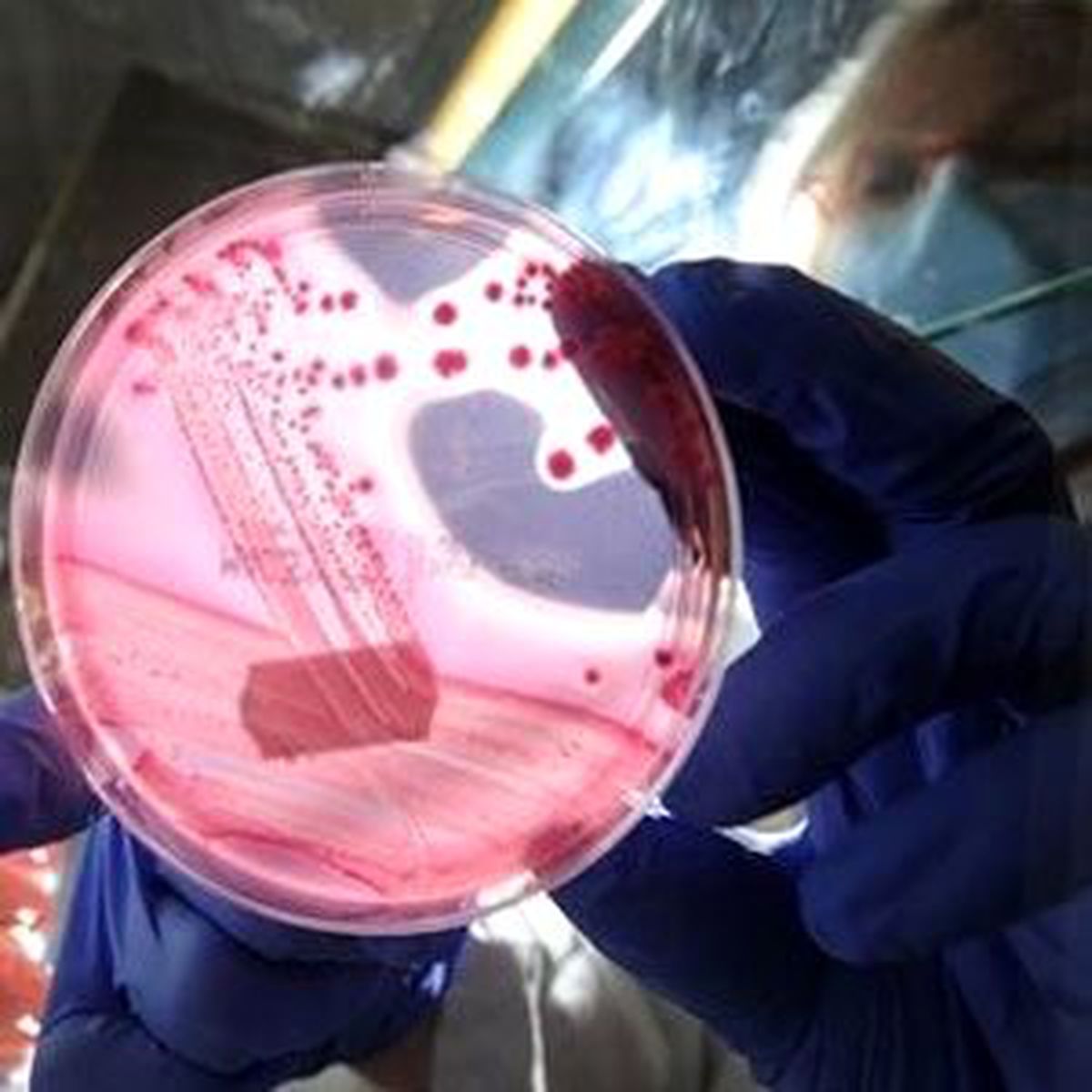 Uganda\'da Yeni Ebola Salgın: 2 Ölü