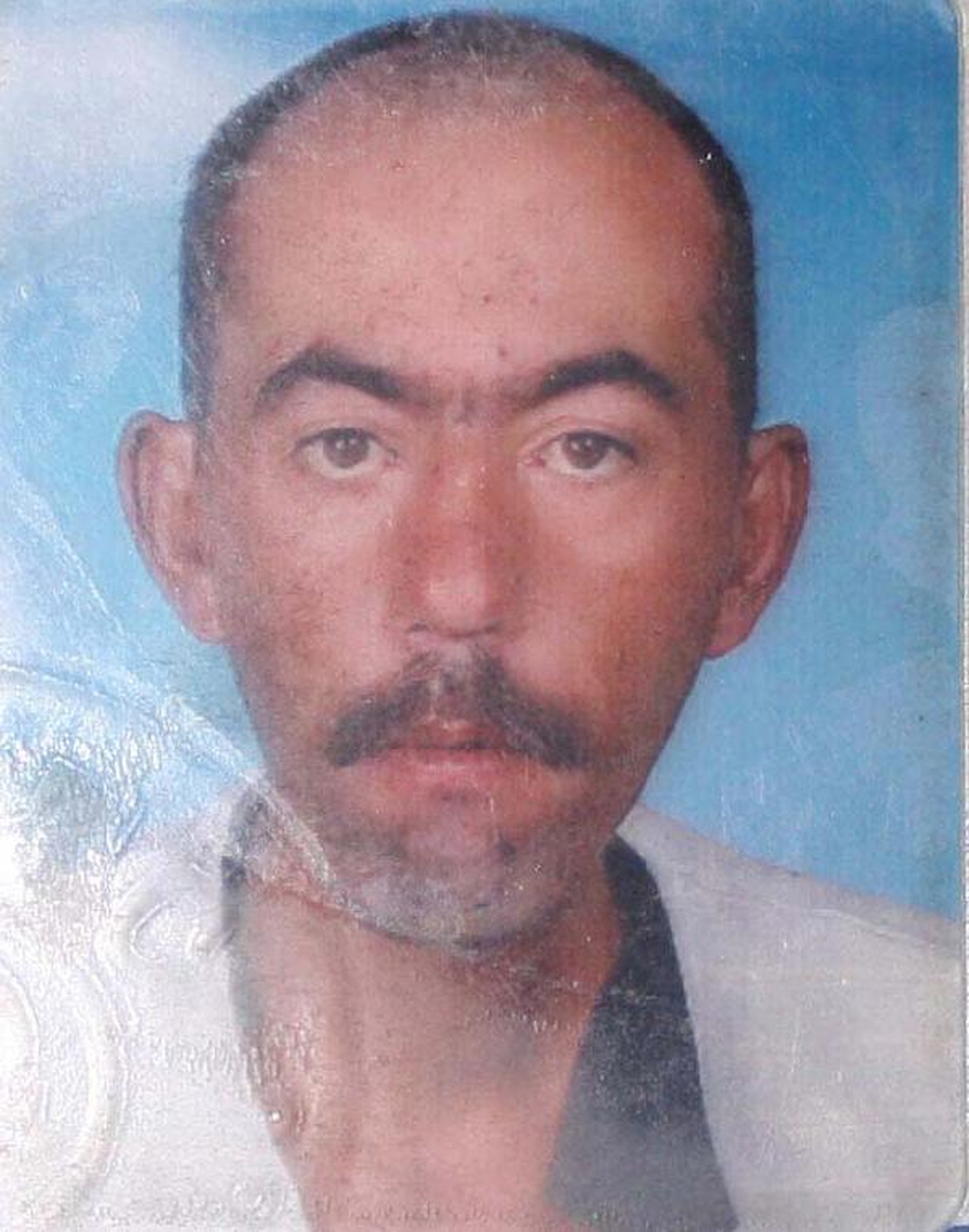 Isınması İçin Yanına Bırakılan Tüp Canından Etti