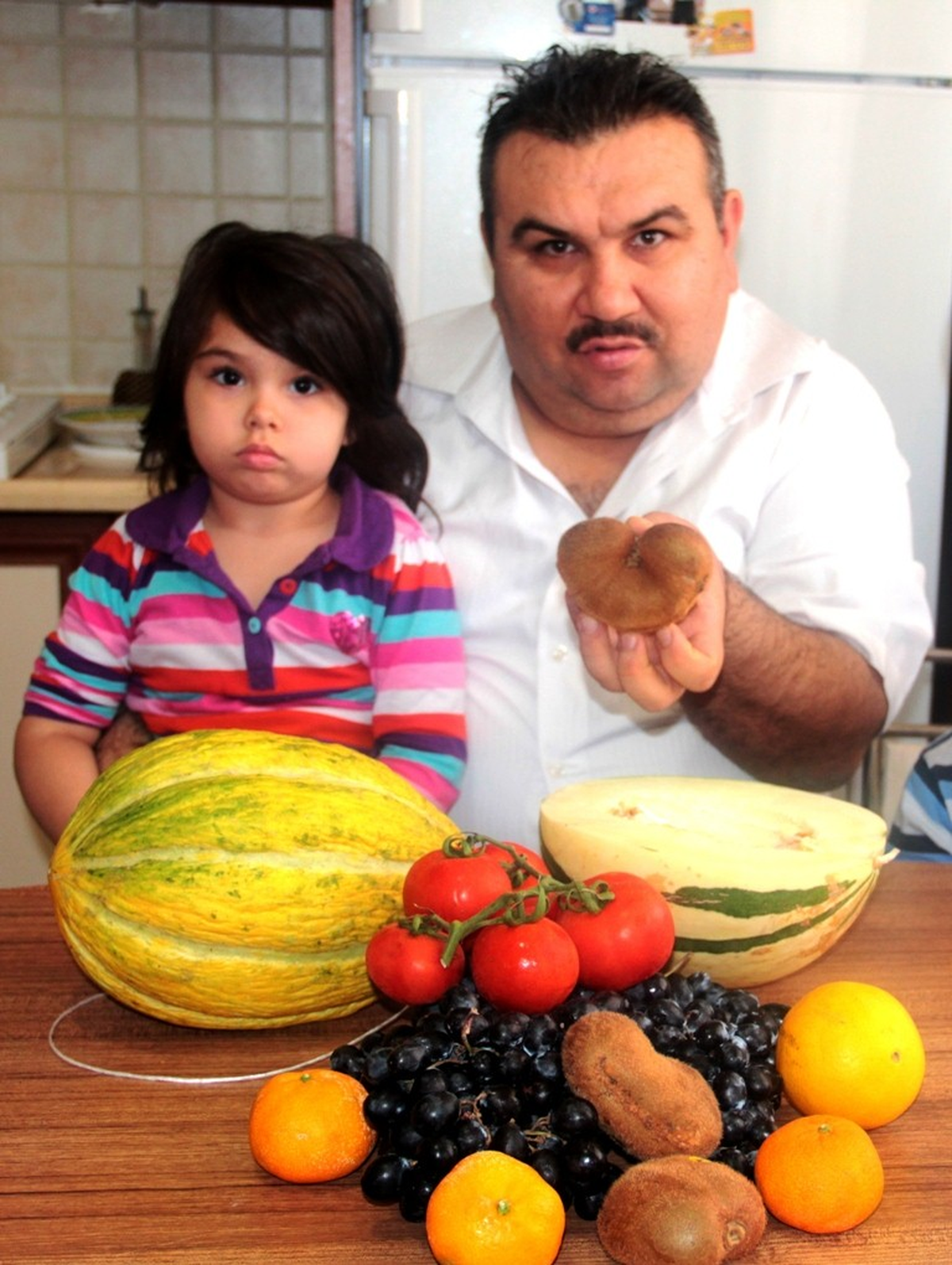 Kalp ve Böbrek Görünümlü Kivi Şaşırttı