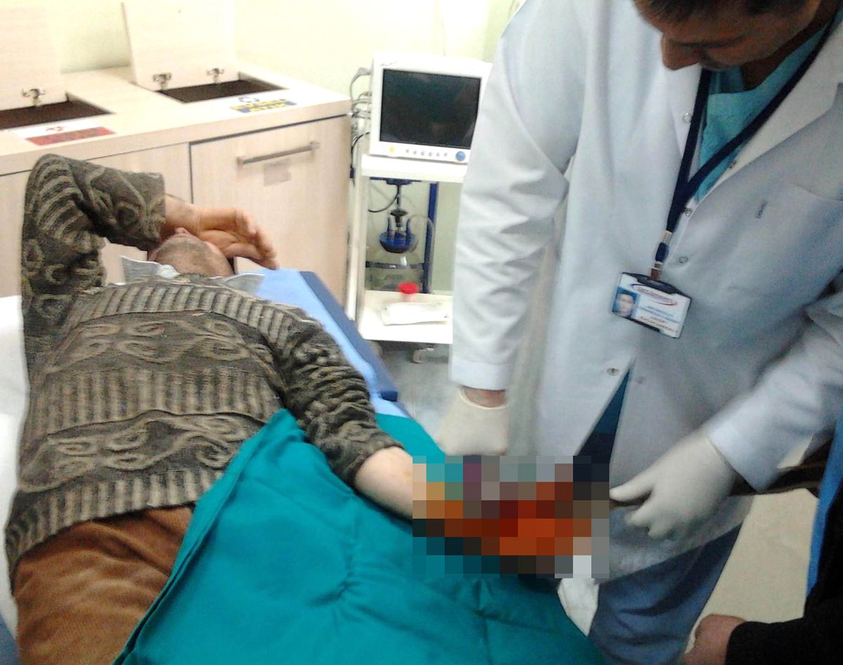 Kesmek İstediği Tahta Eline Saplandı