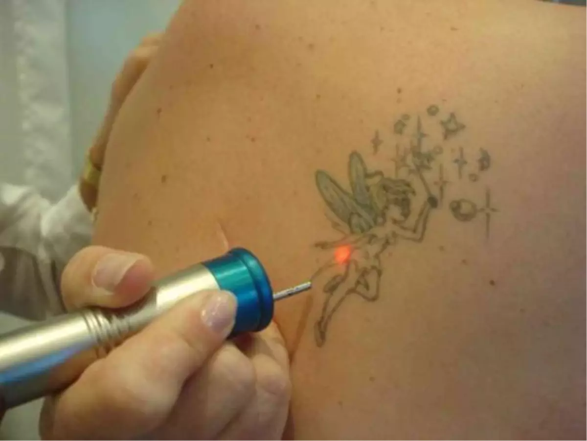 DÖVME YAPTIRIRKEN DİKKAT EDİLMESİ GEREKENLER