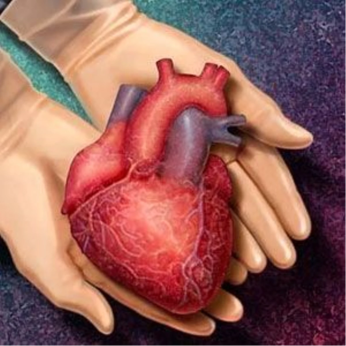 "Yapay Kalp" Hastaların Yaşam Umudu Oldu