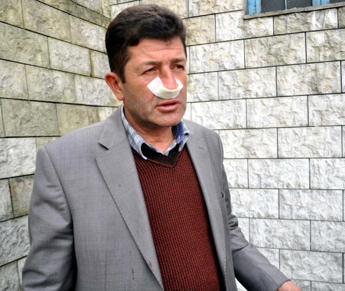 Ambulans Sürücüsünün Burnunu Kırdı