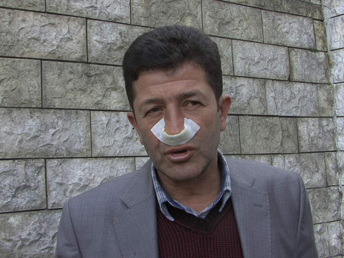 Ambulansın Aynası Çarpınca Şoförü Dövdü