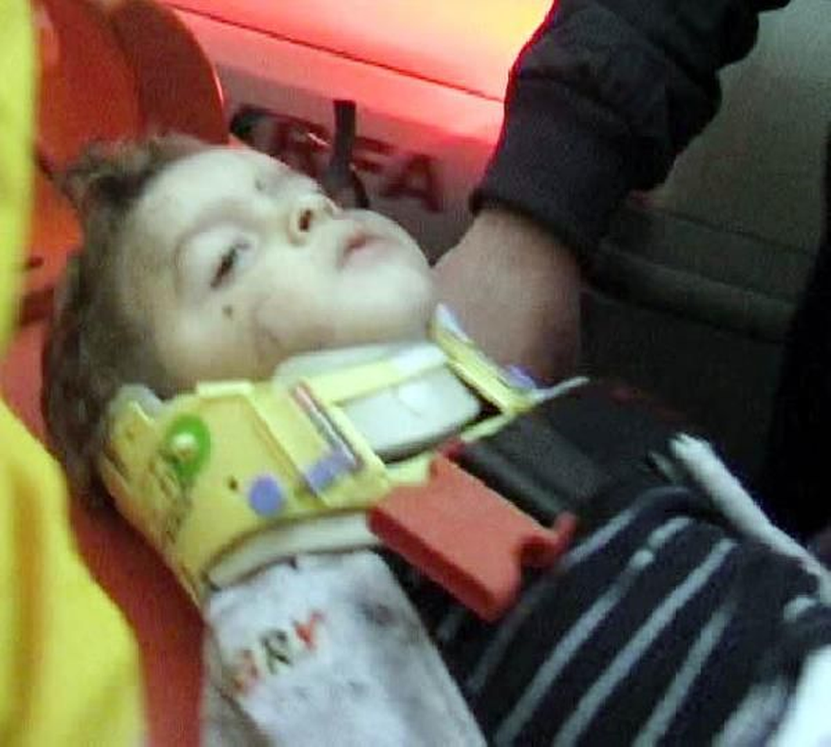 Suriyeli Küçük Çocuk Yaşam Savaşını Kaybetti