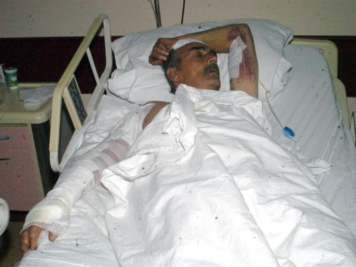 Sevk Edilen Hastanın Ambulansta Kolu Yandı