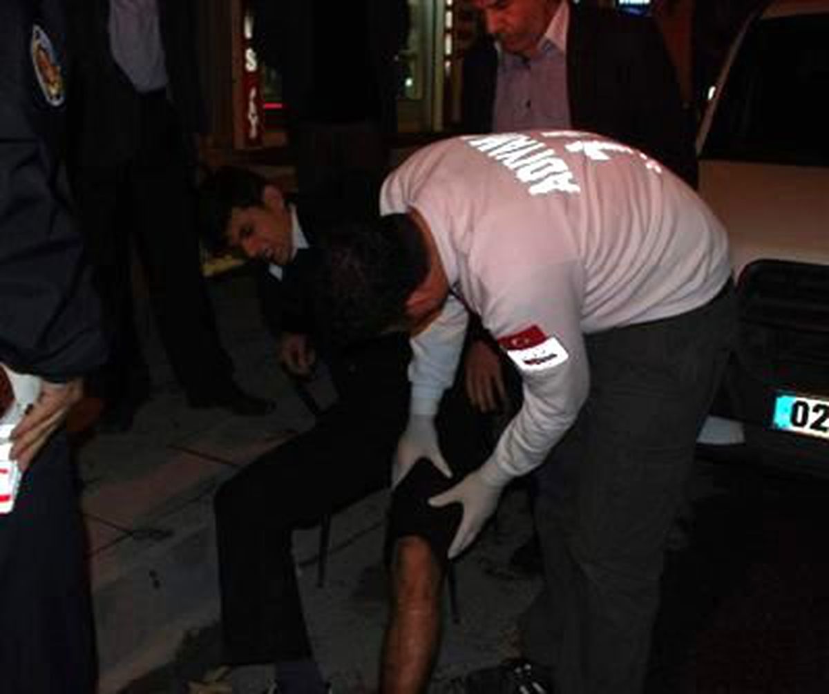 Kontolden Çıkan Motosiklet Devrildi: 1 Yaralı