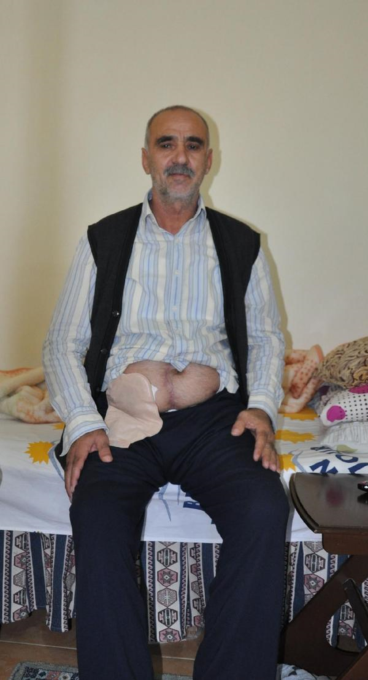 İç Organları Ters Tarafta