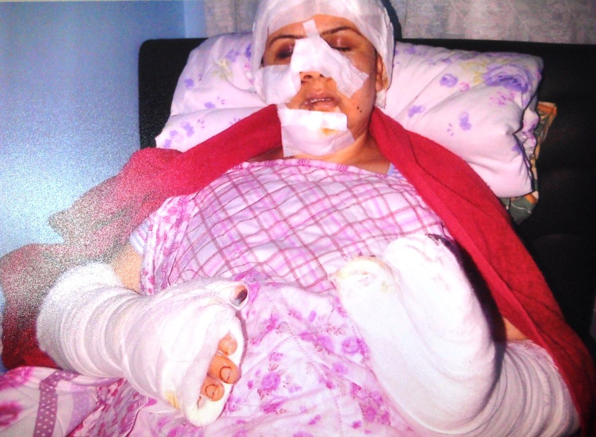 Eşine Bıçakla Şiddet Uygulayan Koca Hakim Karşısında