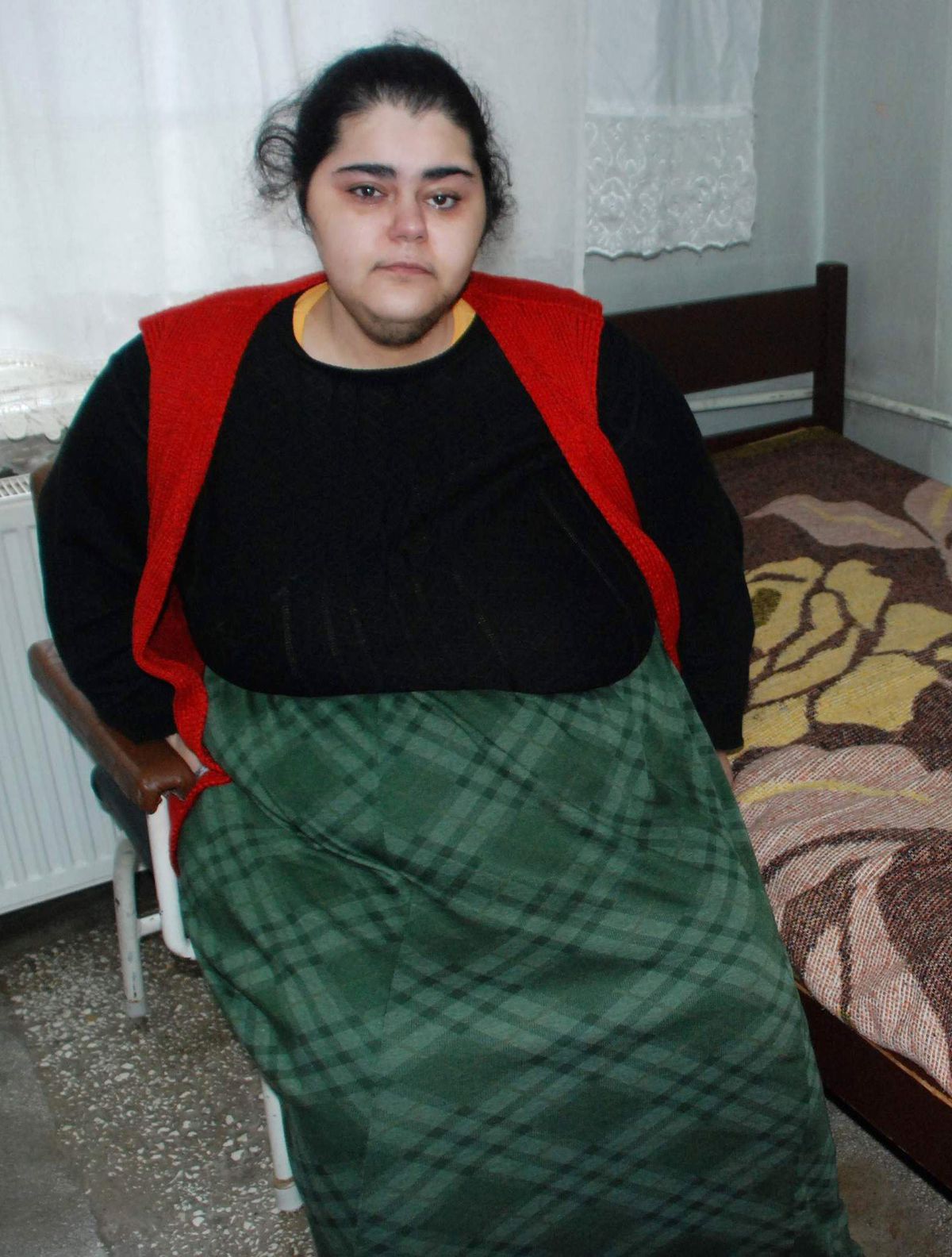Obezite Hastası Sevda 25 Yıldır Yürümeye Hasret