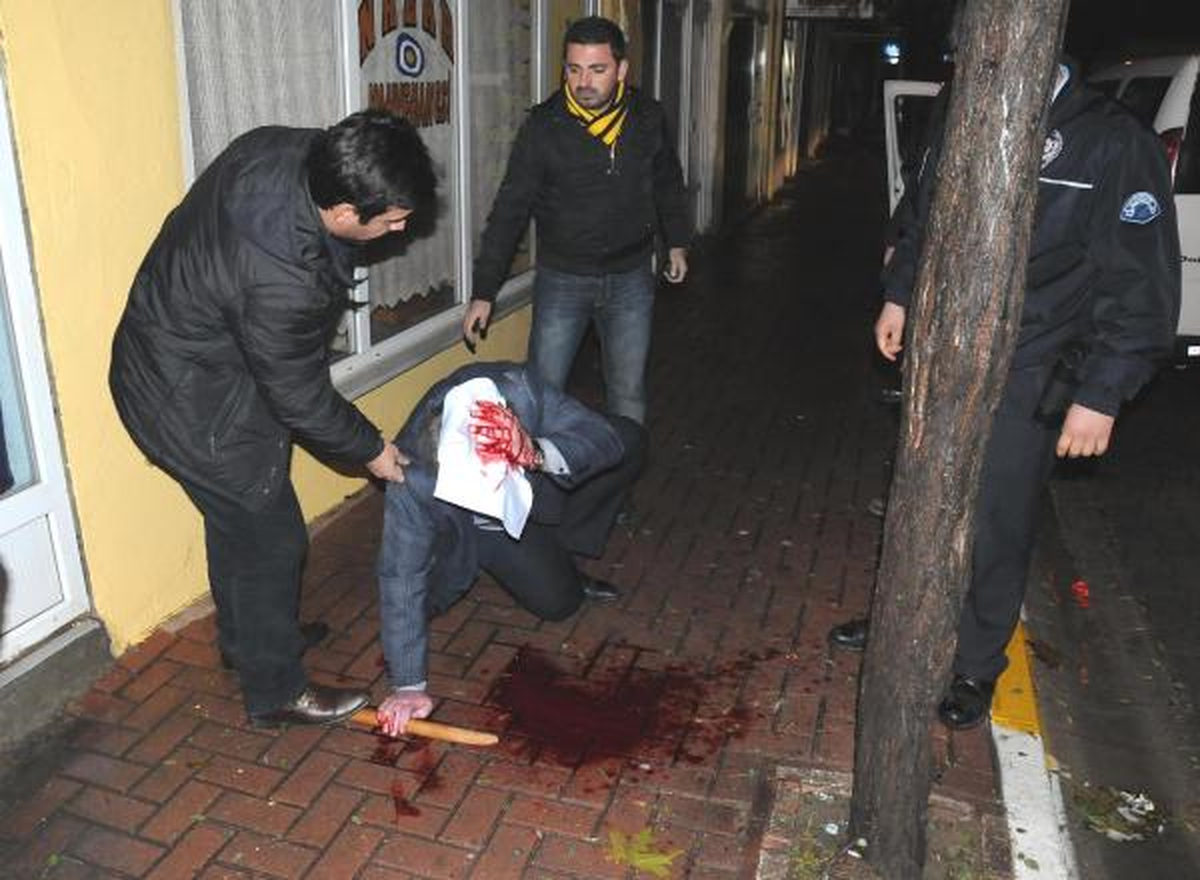 Yolverme Kavgasında, MHP\'li Meclis Üyesi Tutuklandı