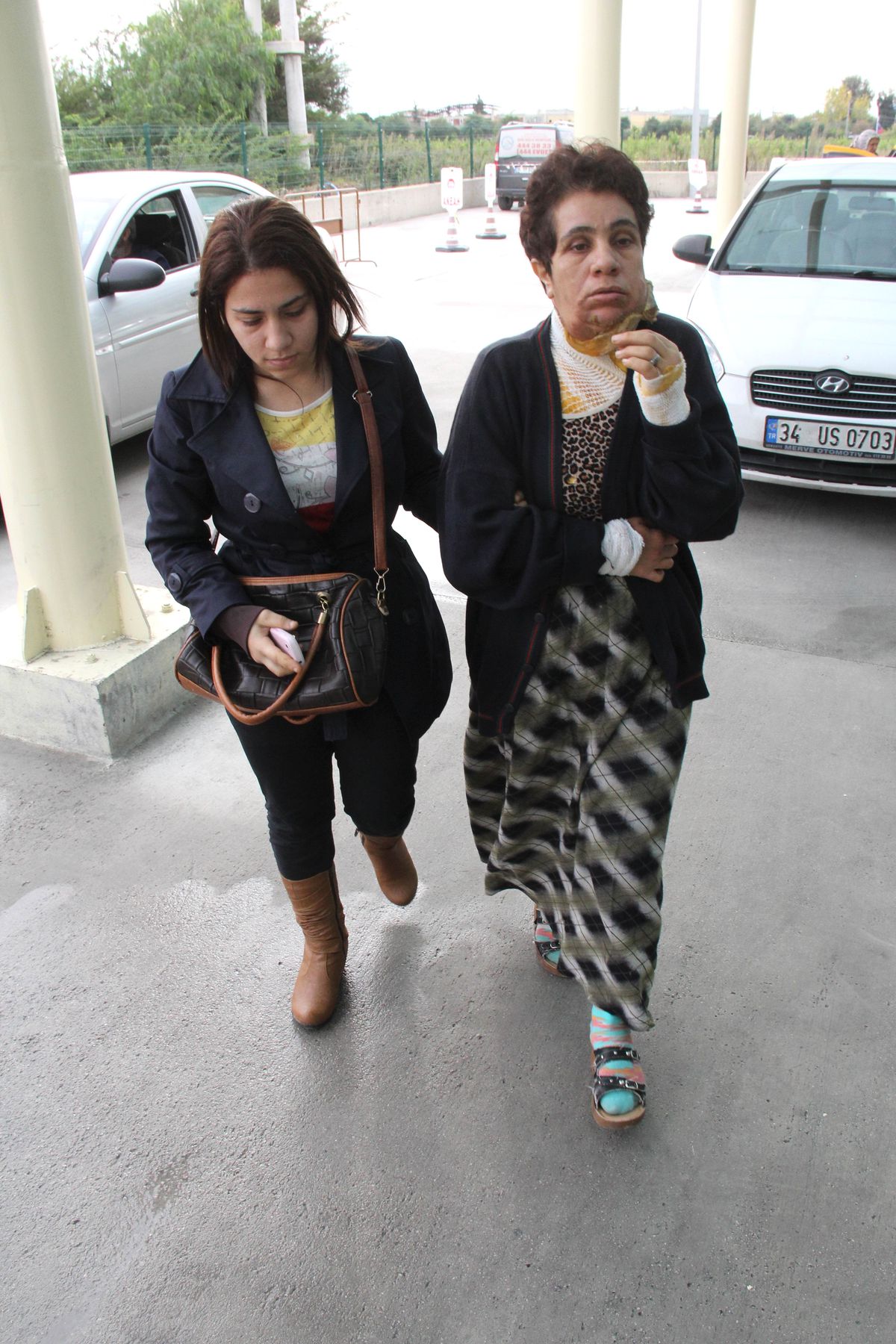 "Cayır Cayır Yanmak İstedim"