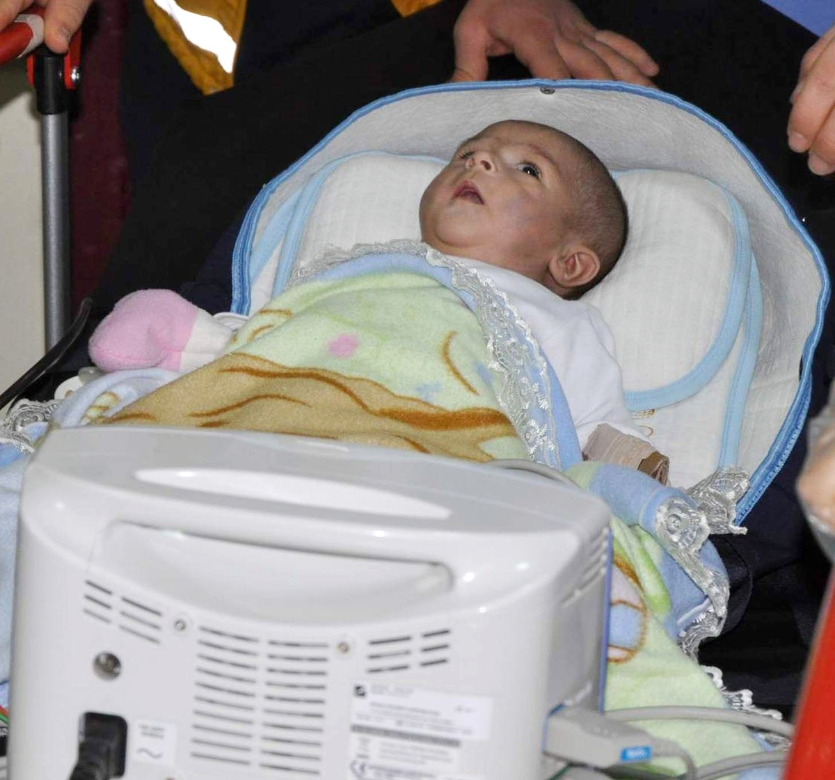 Beyin Kanaması Geçiren 2.5 Aylık Bebek Yoğun Bakıma Alındı
