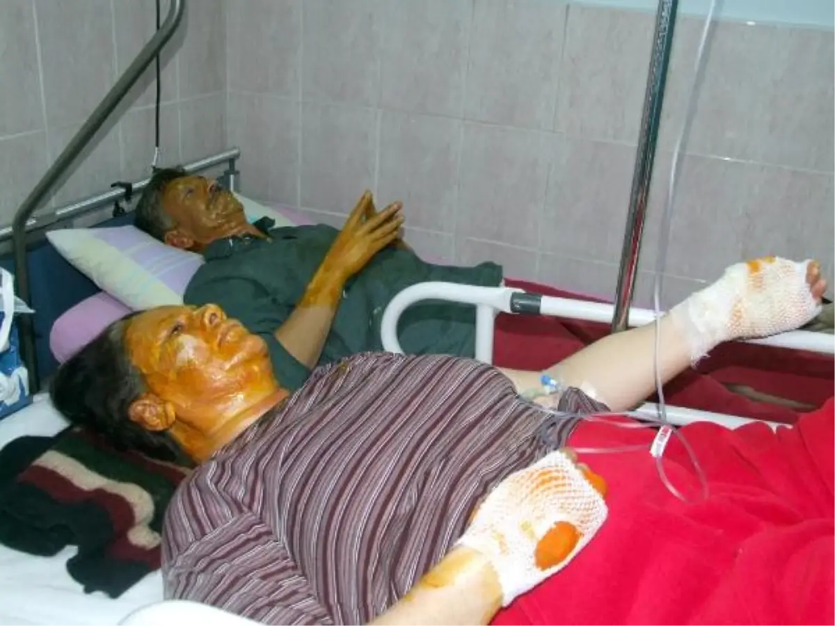 Tüpten Sızan Gaz Patlamaya Neden Oldu: 2 Yaralı