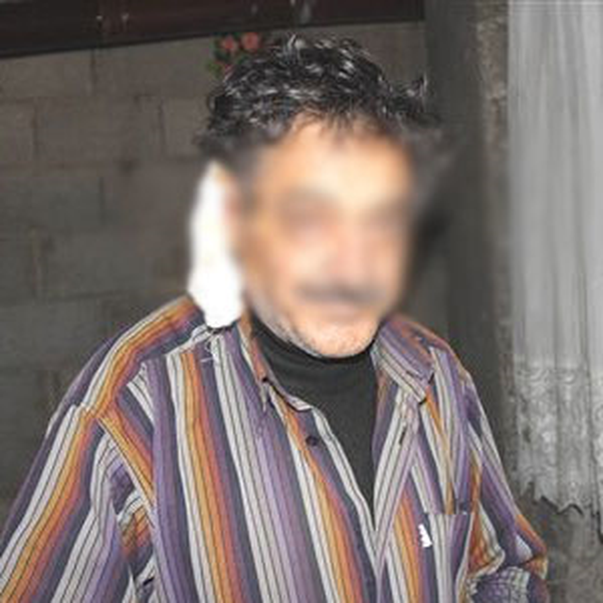 Eve Bakmayan Kocasının Kulağını Kesti