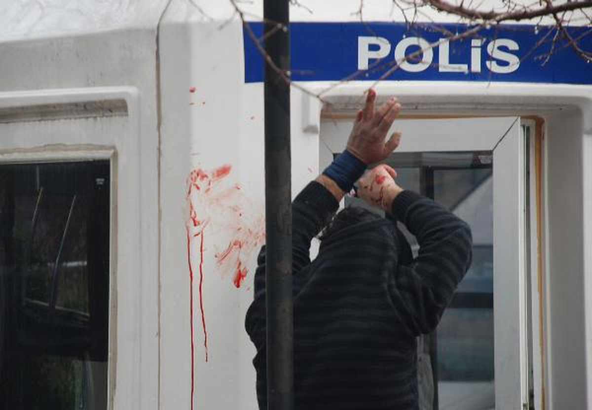 Satırlı Kavgada Elinden Yaralandı, Kaçıp Polise Sığındı