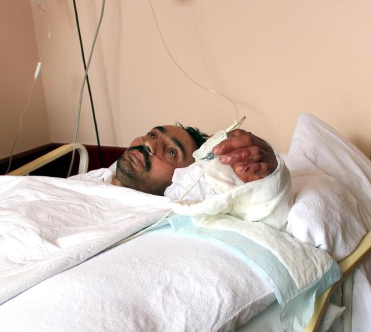 İş Kazasında Kopan Kol Yerine Dikildi