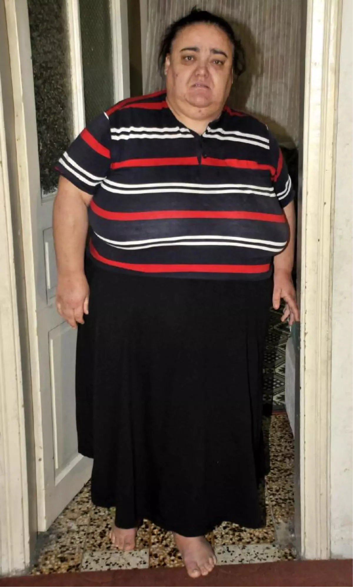 250 Kiloluk Kadın, Zayıflamak İstiyor