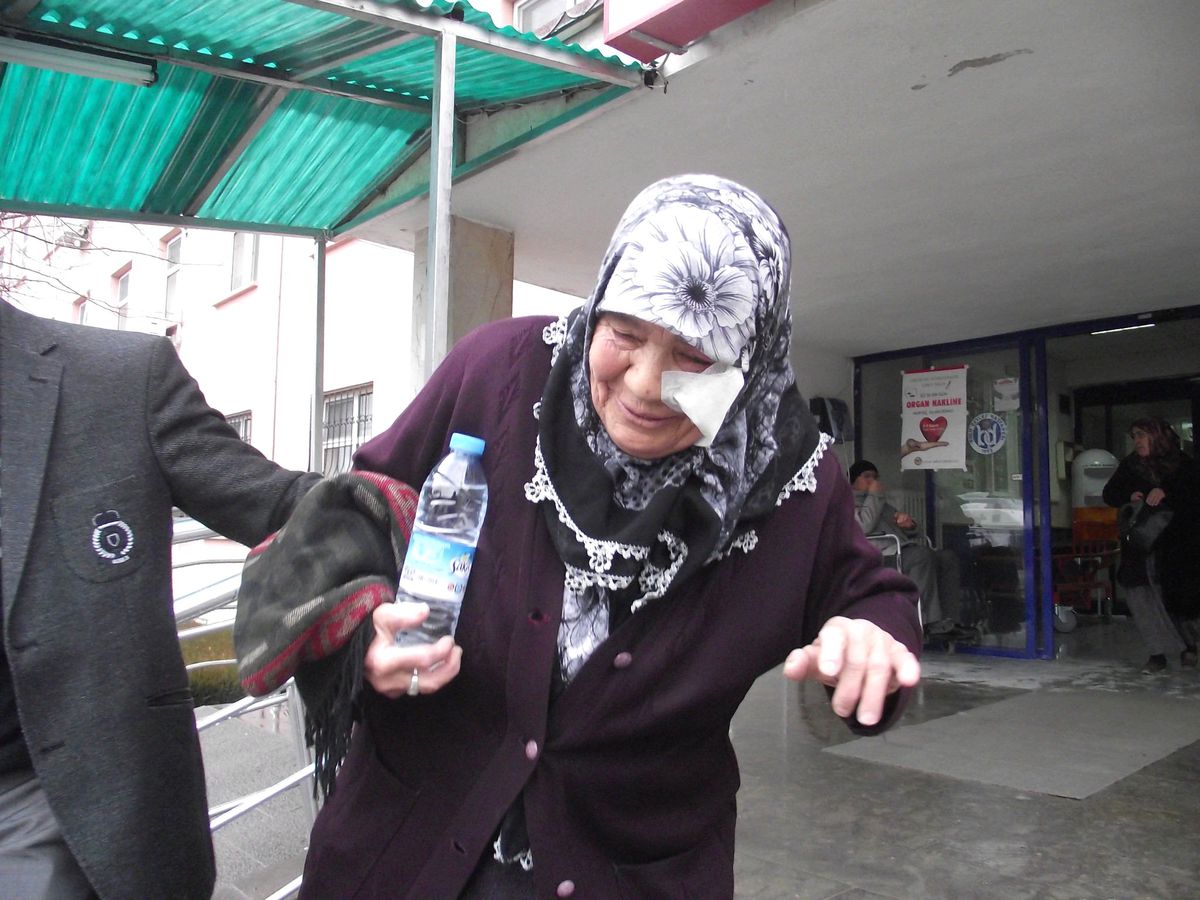 Alevli Hortum, Yaşlı Kadının Yüzünü Yaktı
