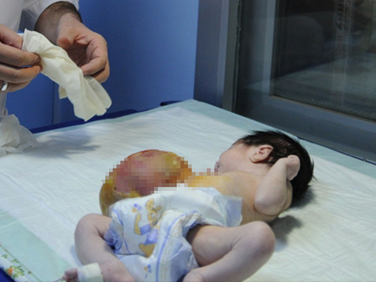 Nur Bebeğin Organları Kesesinde