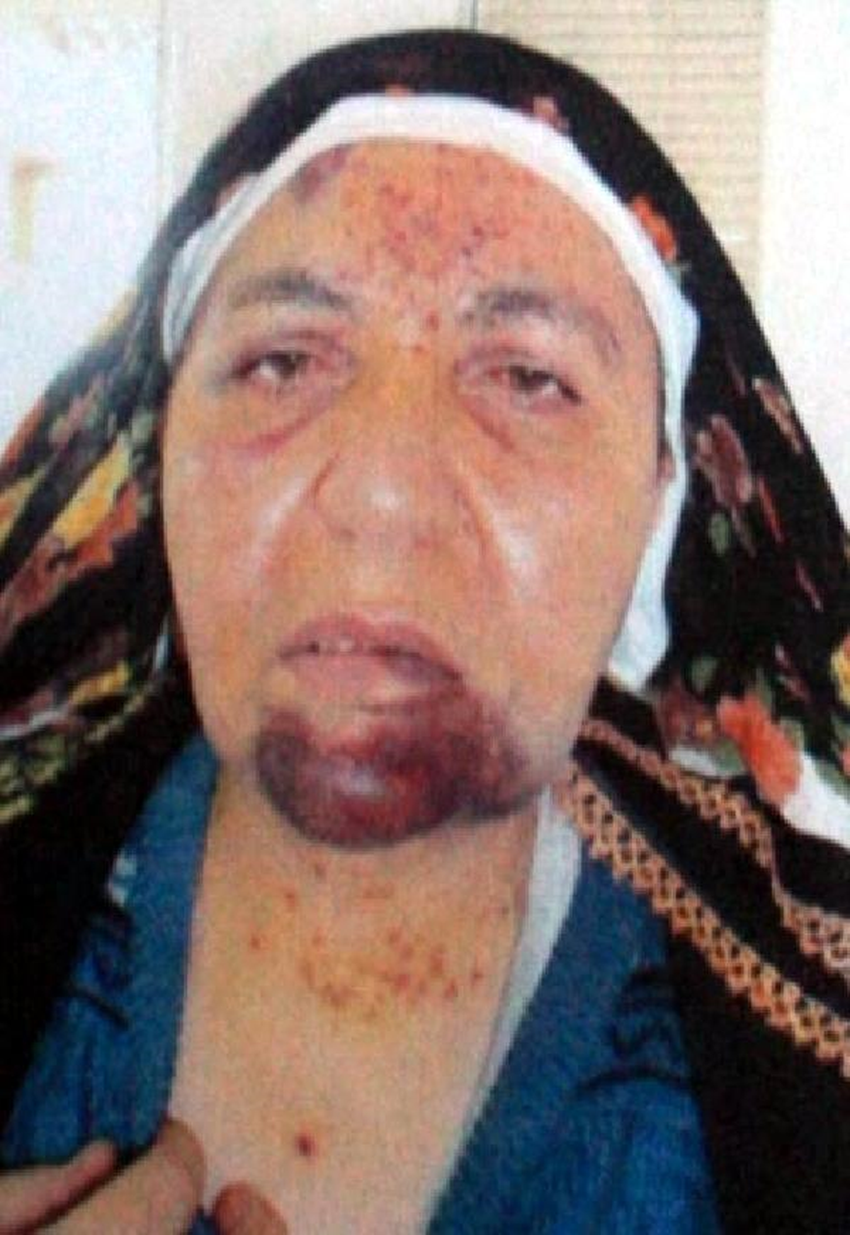 Eşini Dövüp, Kuru Sıkı Tabanca ile Yaralayan Koca Tutuklandı