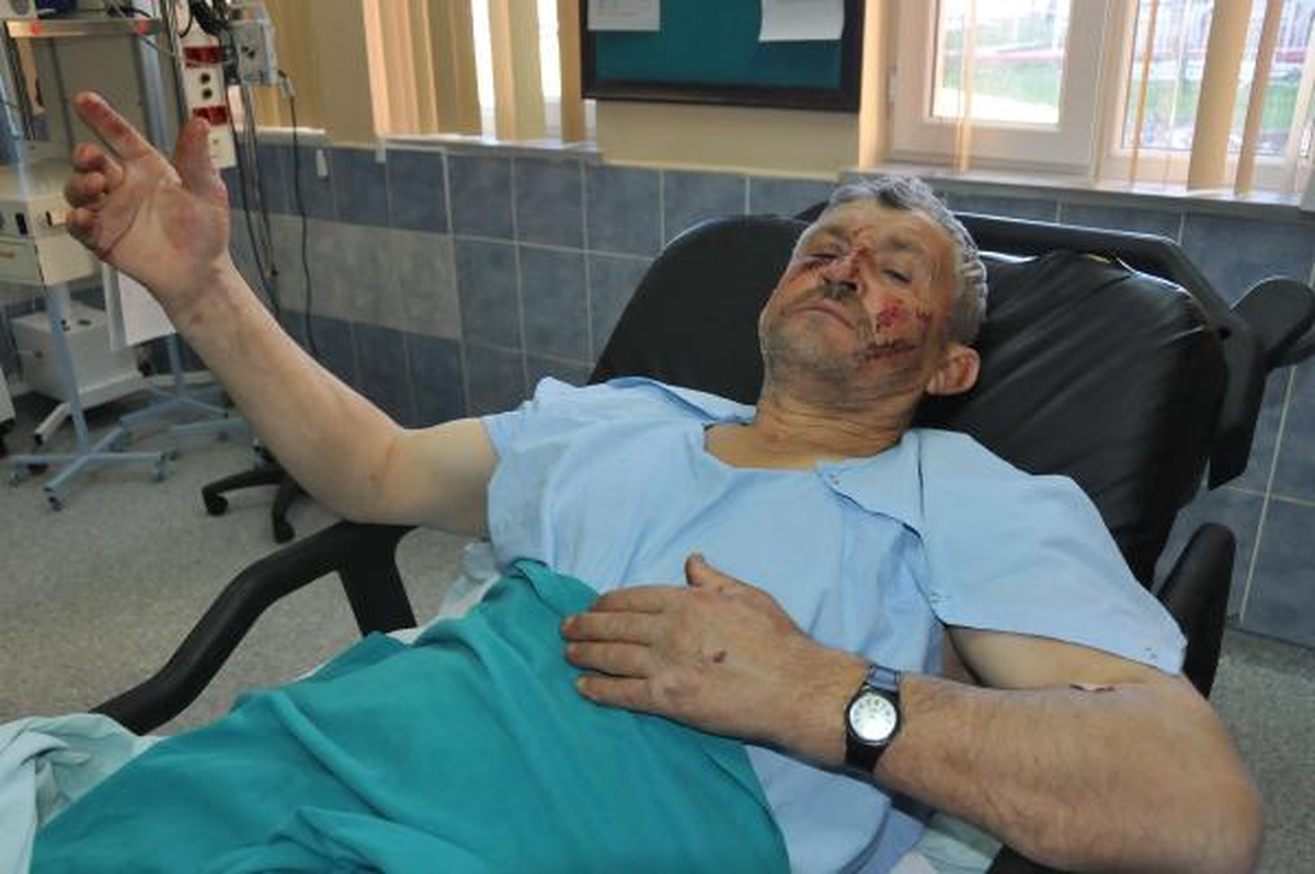 Sivas\'ta Domuz Saldırısına Uğrayan İki Kişi Yaralandı