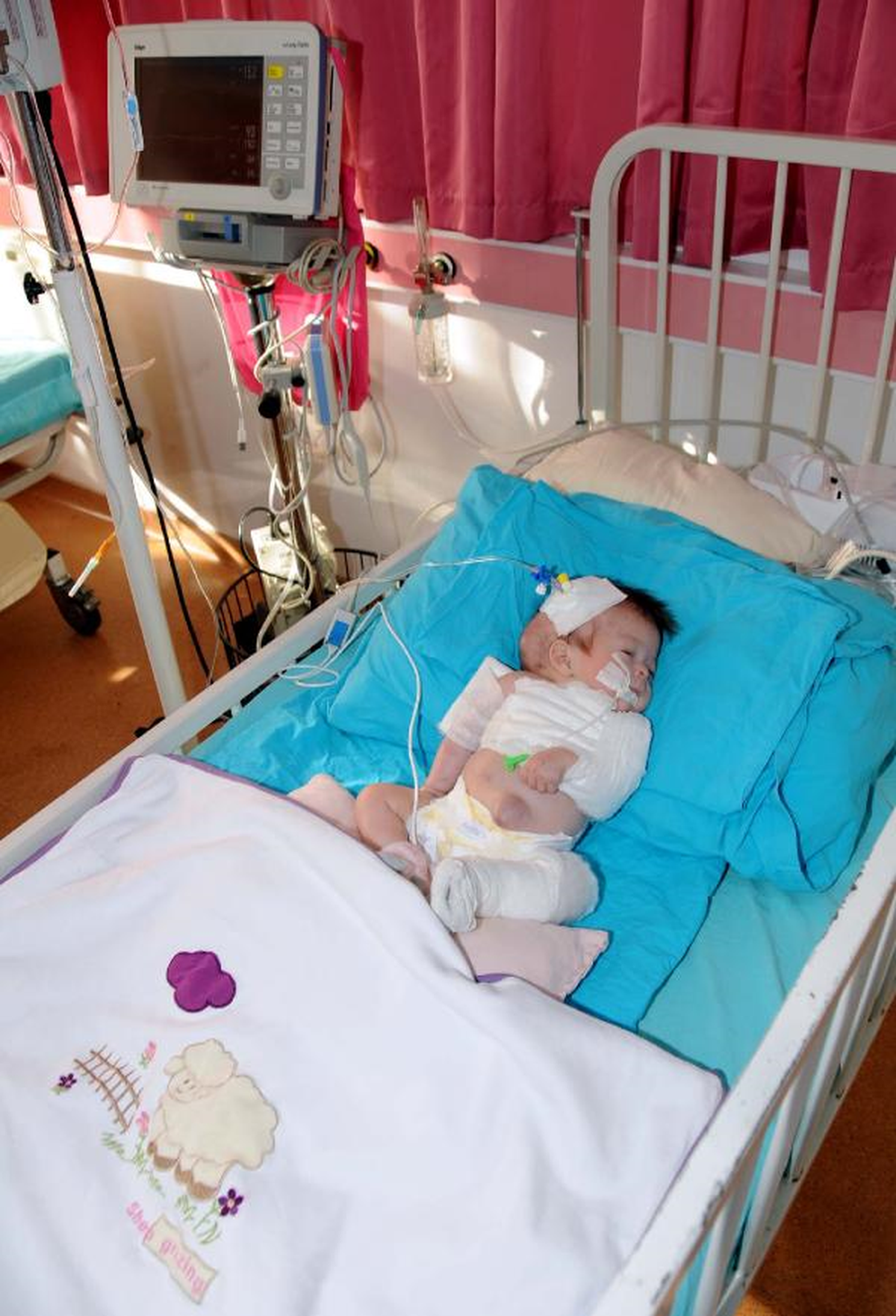 Hastane 1 Ay Önce 'Anne Refakatindeki Bebekte Darp Var' Demiş, Devlet Bebeği Anneye Teslim Etmiş