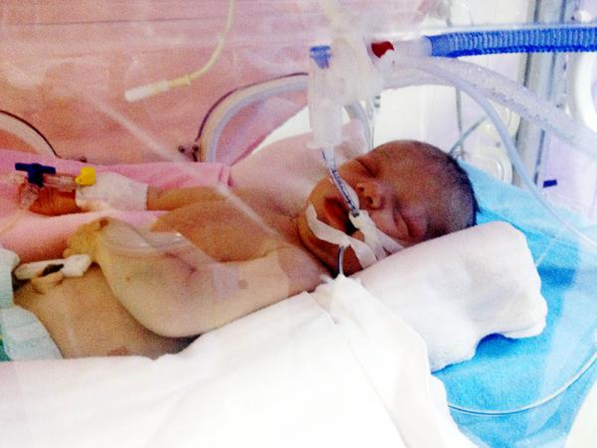 Talihsiz Bebek İçin En Zor Bekleyiş