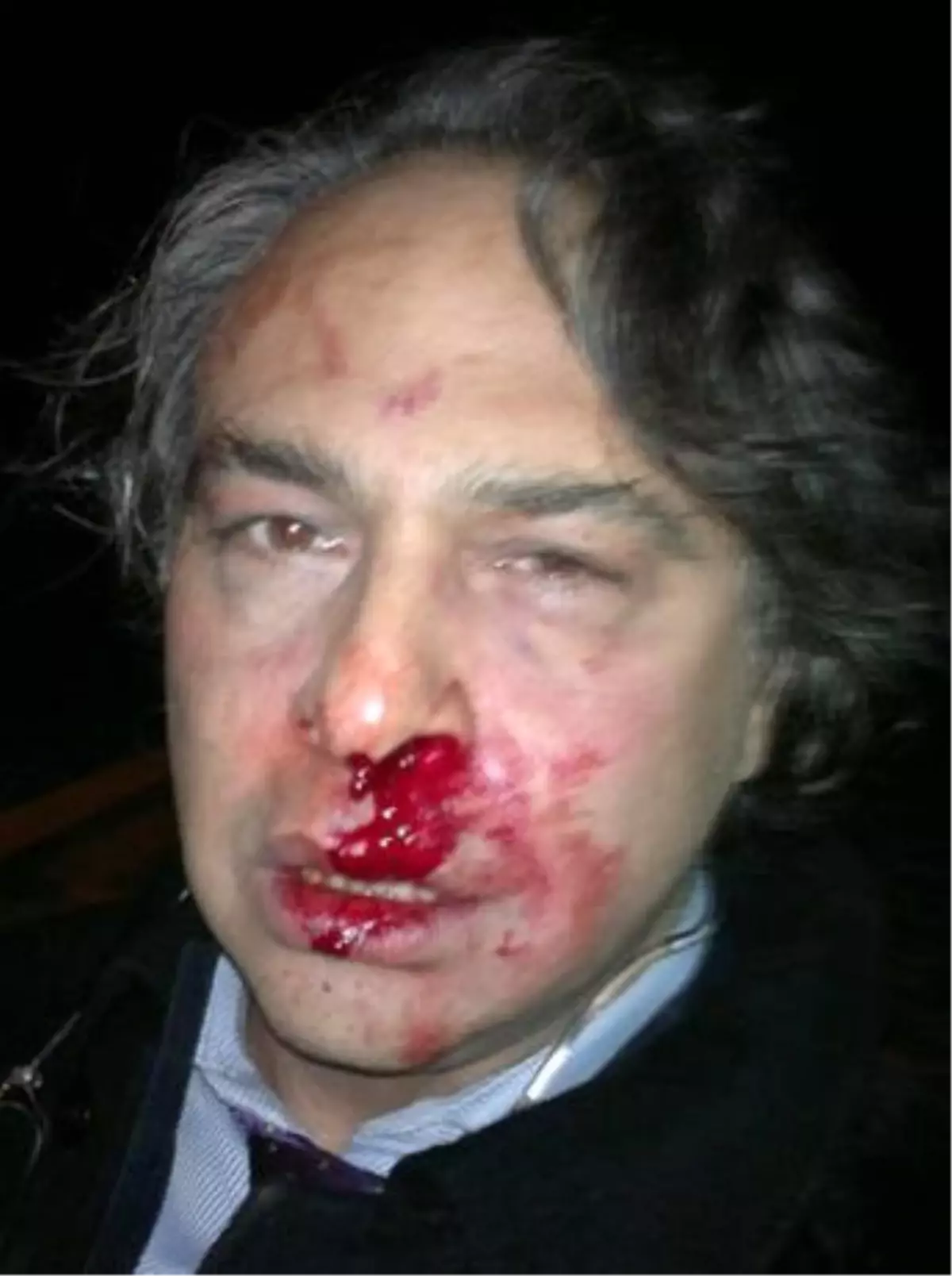 Ünlü Modacı Barbaros Şansal\'ı Dövdüler