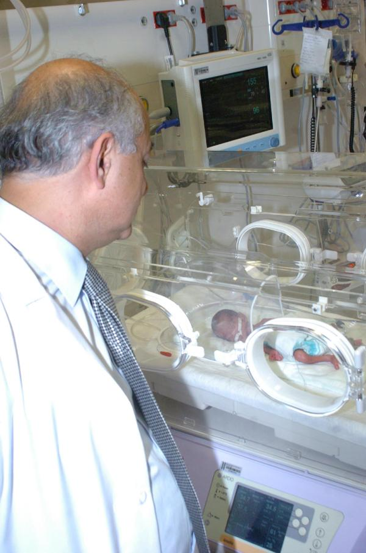 Anne Karnındayken İkizini Kaybeden 26 Haftalık Bebeğin Yaşam Mücadelesi
