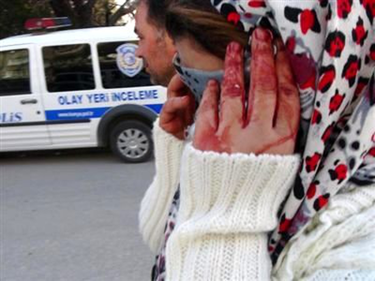 Boşanma Davası Süren Eşini Sevgilisiyle Yakaladı, Boğazından Bıçaklandı(2)