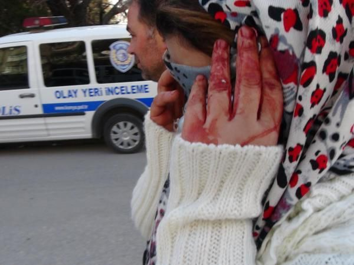 Sevgilisinin Boğazından Bıçakladığı Eşine Tampon Yapmış (2)