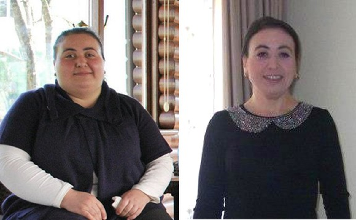 Dengeli Diyetle 58 Kilo Verdi