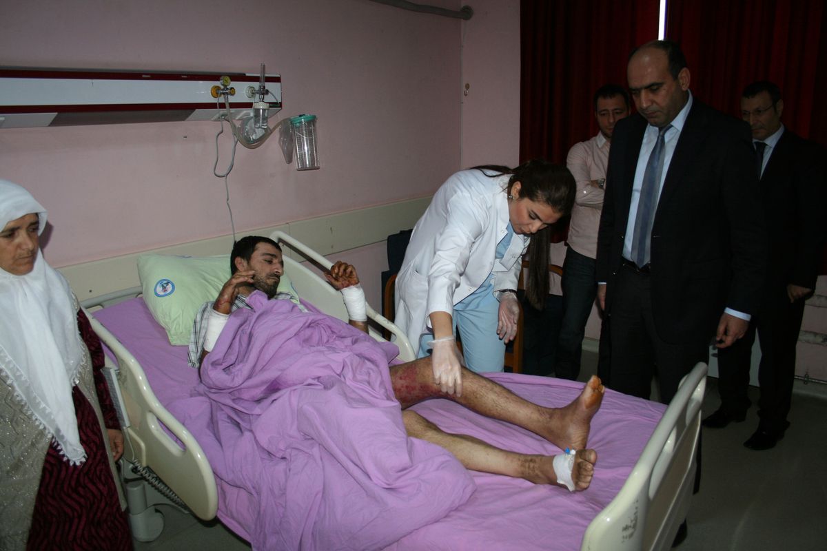 Bbdh Plastik Cerrahide Elektrik Yanığına Maruz Kalan Bir Hasta Ameliyat Edildi