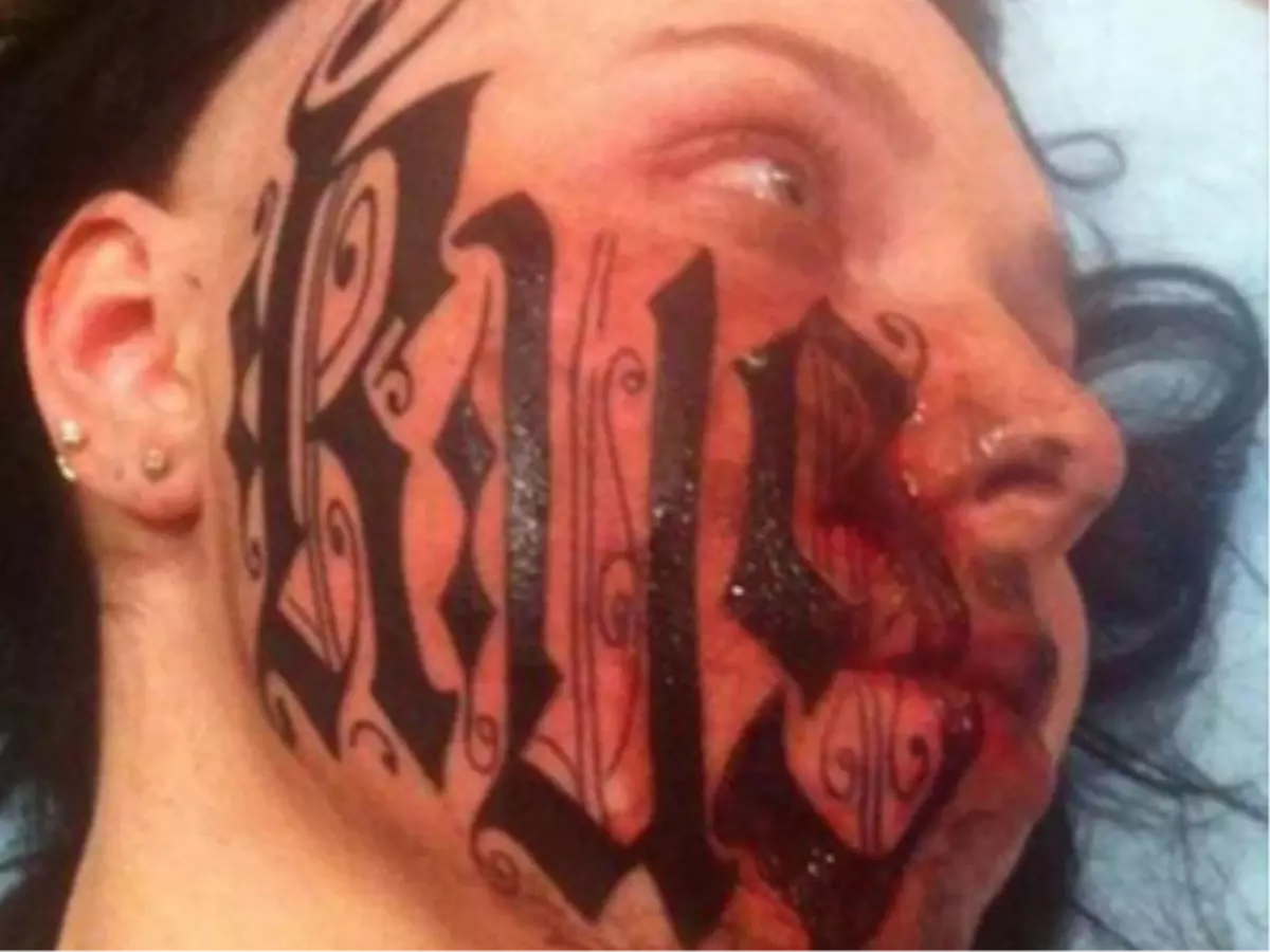 Sevgilisinin Yüzüne Kendi Adını Kazıdı