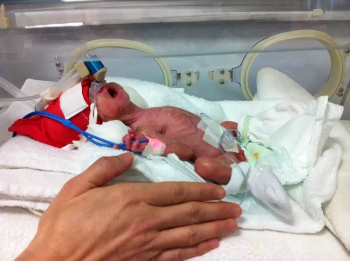 Parmak Çocuk Hayata Tutundu