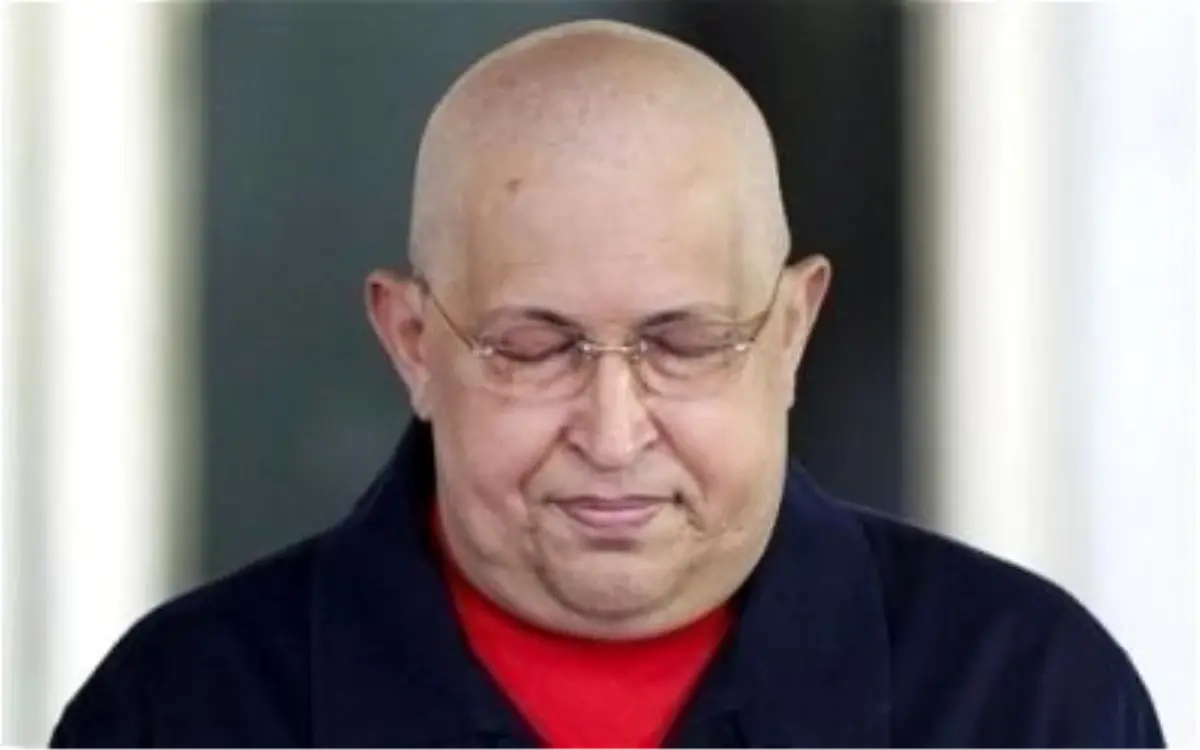 Venezuela Devlet Başkanı Chavez\'in Sağlık Durumu