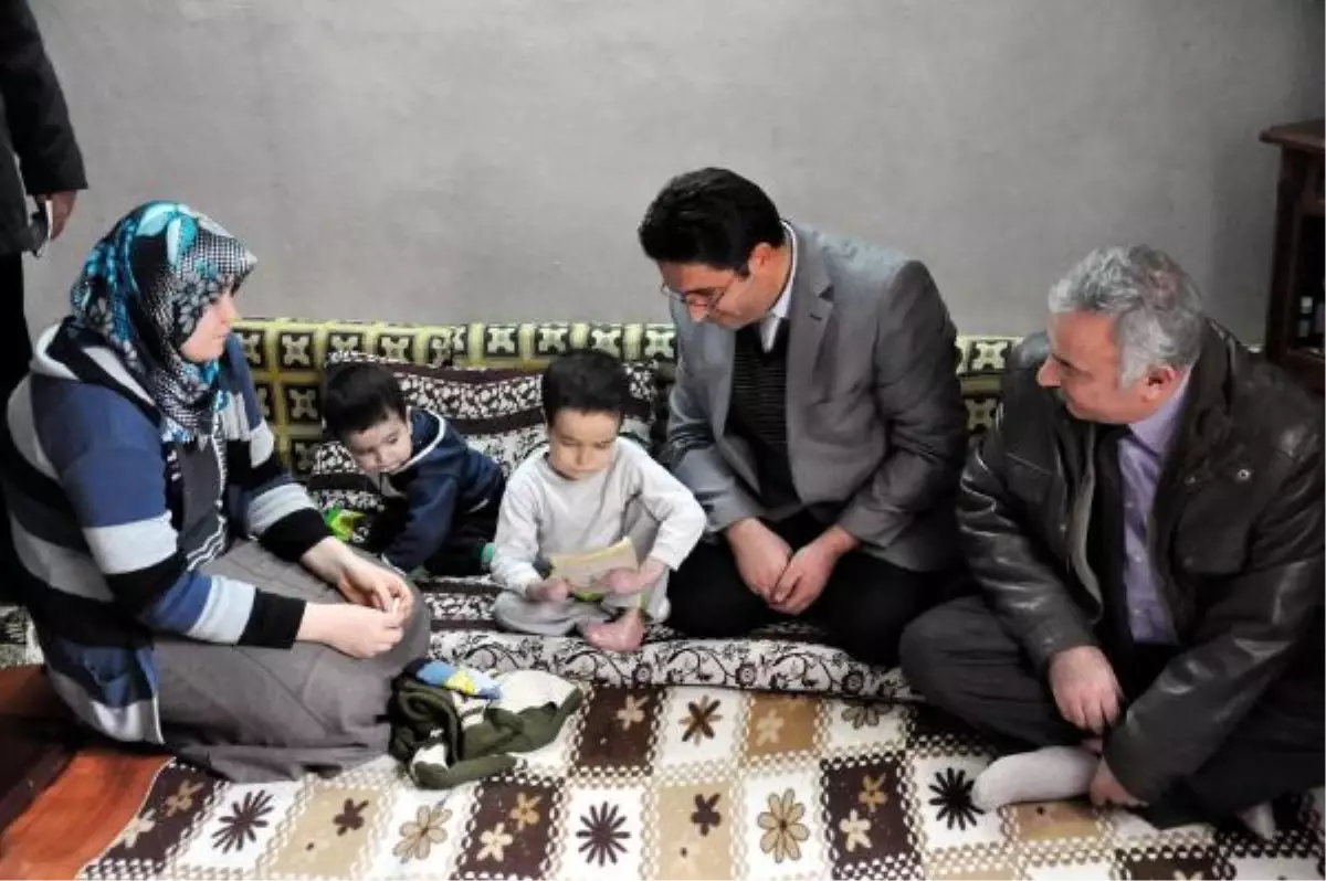 Vücutları Eriyen Kardeşlere Yardım Eli