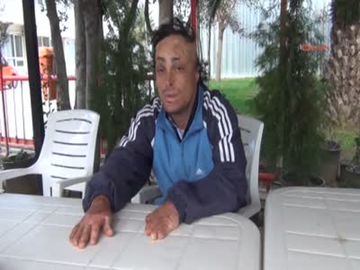 O da Yüz Nakli İstiyor